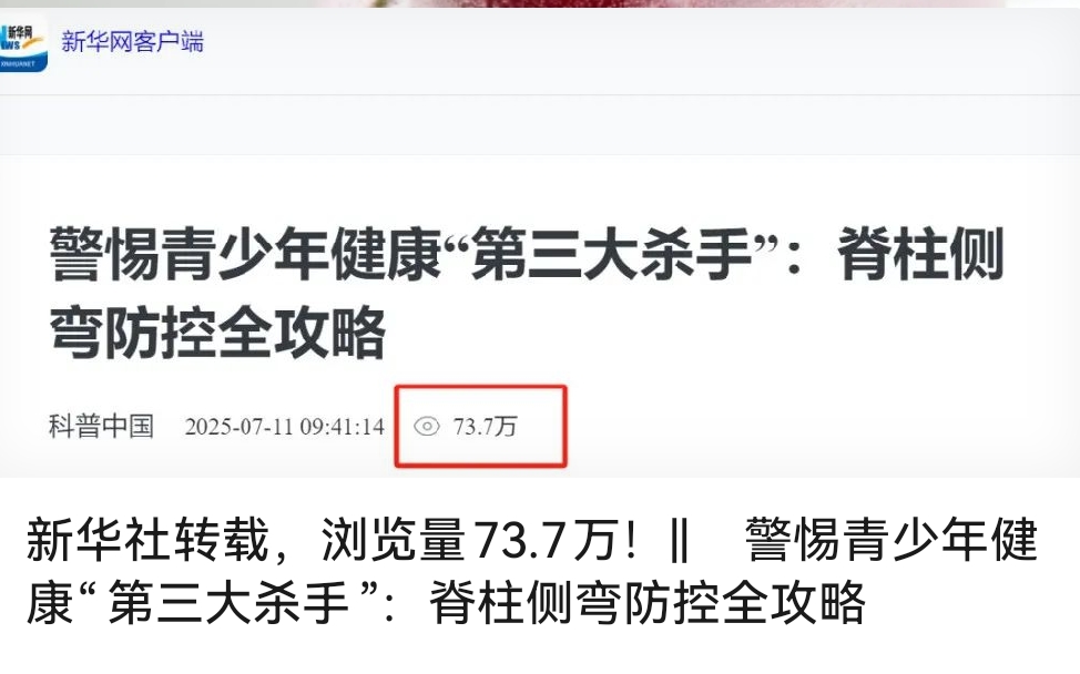 新华社转载，浏览量73.7万！|| 警惕青少年健康&ldquo;第三大杀手&rdquo;：脊柱侧弯防控全攻略